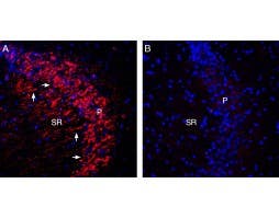 Anti-Ca<sub>V</sub>3.3 (CACNA1I) Antibody