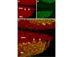 Anti-TRPC1 Antibody