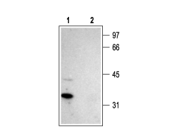 Anti-Stargazin Antibody