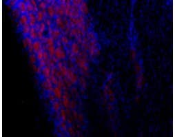Anti-TRPC3-ATTO Fluor-594 Antibody