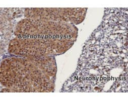 Anti-TRPC3 Antibody