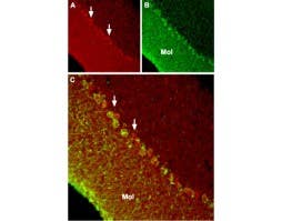 Anti-TRPC6 Antibody
