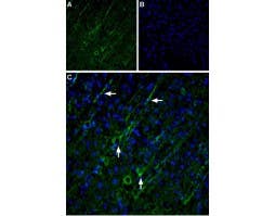 Anti-TRPC5 Antibody