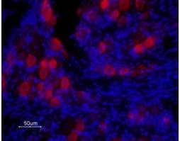 Anti-TRPV1 (VR1) (extracellular) Antibody