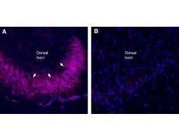 Anti-TRPV1 (VR1)-ATTO Fluor-647N Antibody