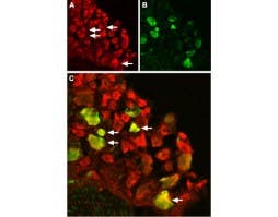 Anti-TRPV1 (VR1) Antibody