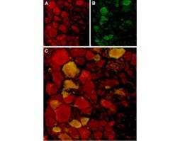 Anti-TRPV4 Antibody