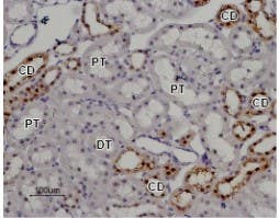 Anti-TRPV5 Antibody