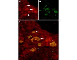 Anti-TRPV6 Antibody
