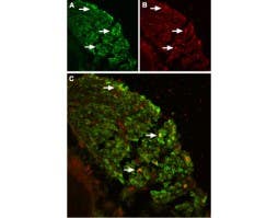 Anti-TRPV2 (VRL1) (extracellular) Antibody