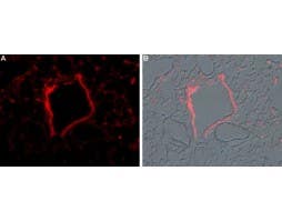 Anti-TRPM2-ATTO Fluor-594 Antibody