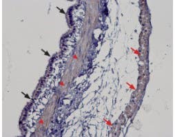 Anti-TRPM2 Antibody