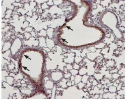Anti-TRPM4 Antibody