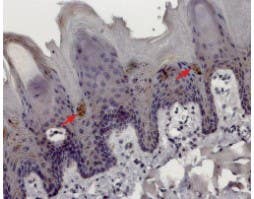 Anti-TRPM5 Antibody