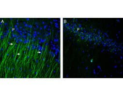 Anti-TRPM6 (extracellular) Antibody