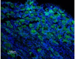 Anti-TRPM8 (extracellular) Antibody