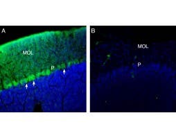Anti-TRPM3 (extracellular) Antibody