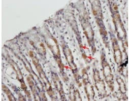 Anti-STIM1 (extracellular) Antibody