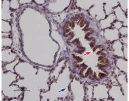 Anti-STIM2 Antibody