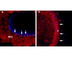 Anti-TMEM66-ATTO Fluor-594 Antibody