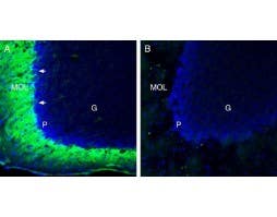 Anti-TMEM66 Antibody