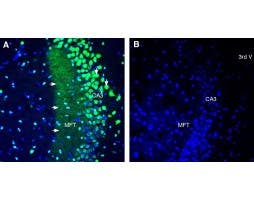 Anti-TRPML1 (Mucolipin 1) Antibody