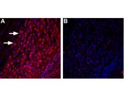 Anti-TRPML3 (Mucolipin 3)-ATTO Fluor-594 Antibody