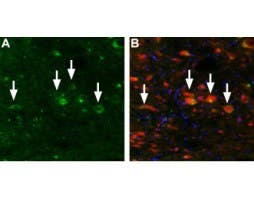 Anti-TRPML3 (Mucolipin 3) Antibody