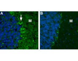Anti-CACNA2D2 (Ca<sub>V</sub>α2δ2) (extracellular) Antibody