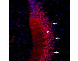 Anti-CACNB2-ATTO Fluor-594 Antibody