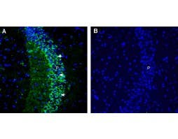 Anti-CACNB2 Antibody