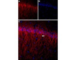 Anti-CACNB1 Antibody