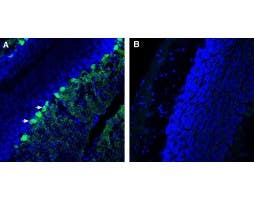 Anti-CACNG7 (extracellular) Antibody