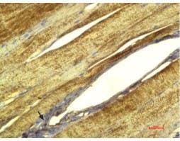 Anti-CACNG1 (extracellular) Antibody