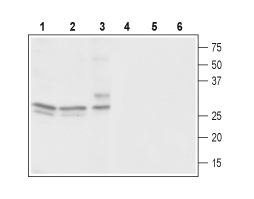 Anti-CACNG3 Antibody