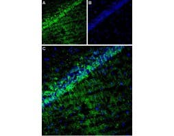 Anti-CACNG8 Antibody