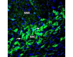 Anti-TRPM2 (extracellular) Antibody