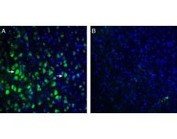 Anti-TRPM7 (extracellular) Antibody