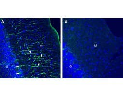 Anti-Ca<sub>V</sub>1.2 (CACNA1C) (extracellular) Antibody