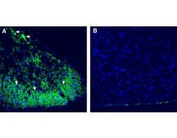 Anti-CALHM2 (extracellular) Antibody