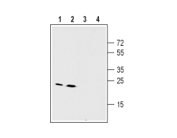 Anti-Connexin-26 (GJB2) Antibody