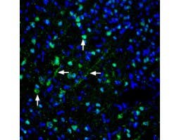 Anti-Pannexin 1 Antibody