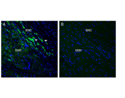Anti-MCU Antibody