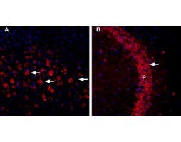Anti-CHERP-ATTO Fluor-594 Antibody