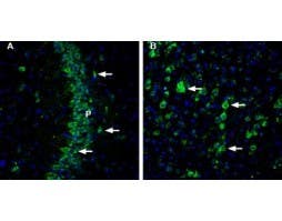Anti-CHERP Antibody
