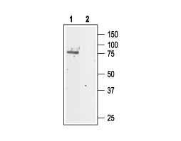 Anti-CLC-5 Antibody