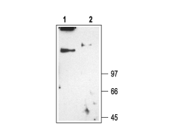 Anti-CLC-1 (CLCN1) Antibody
