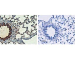 Anti-CFTR Antibody
