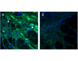 Anti-TMEM16A (ANO1) (extracellular) Antibody
