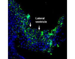 Anti-PMCA3 Antibody